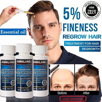 Kirkland Minoxidil 5% Extra Strength Hair Regrowth for Men