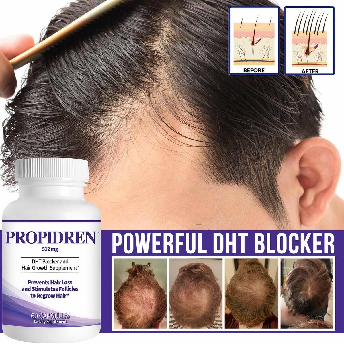 Propidren by HairGenics – DHT Blocker & Hair Growth Supplement